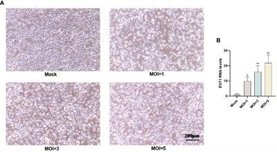 TLR4 signalling: the key to controlling EV71 replication and inflammatory response